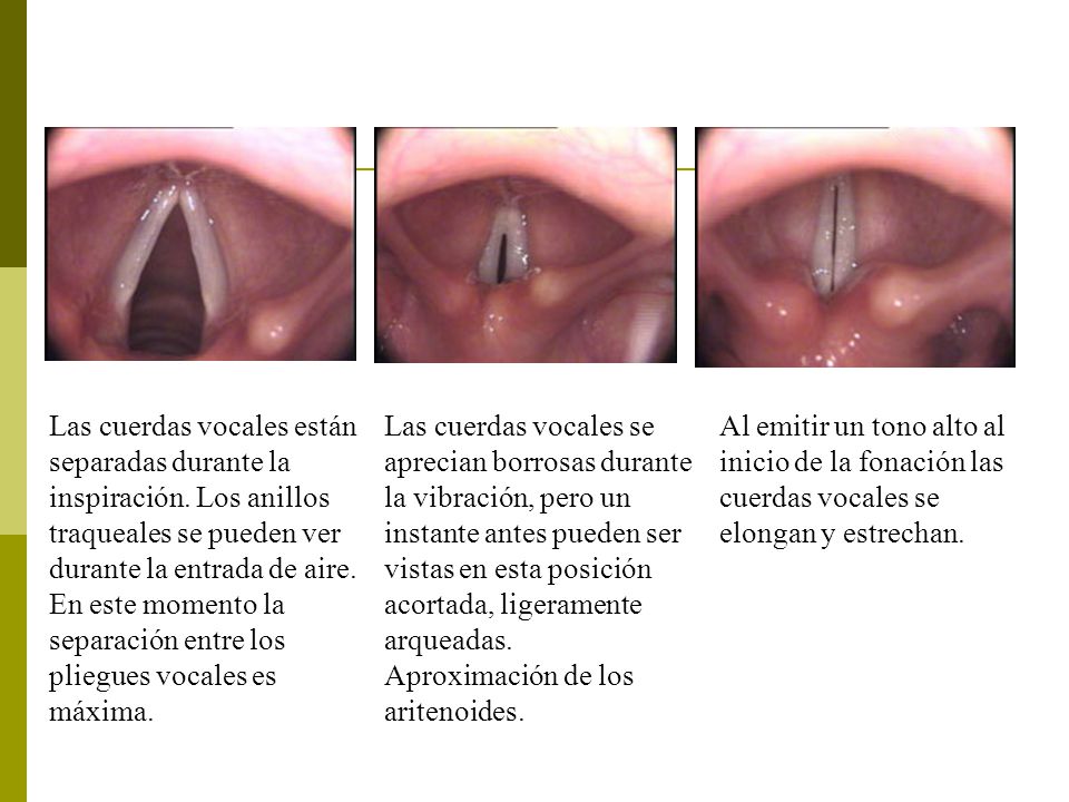 Humano vocales cuantas cuerdas ser tiene el